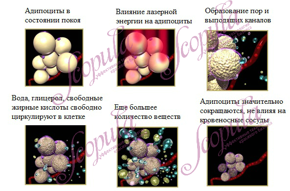 SA-LP2082.jpg